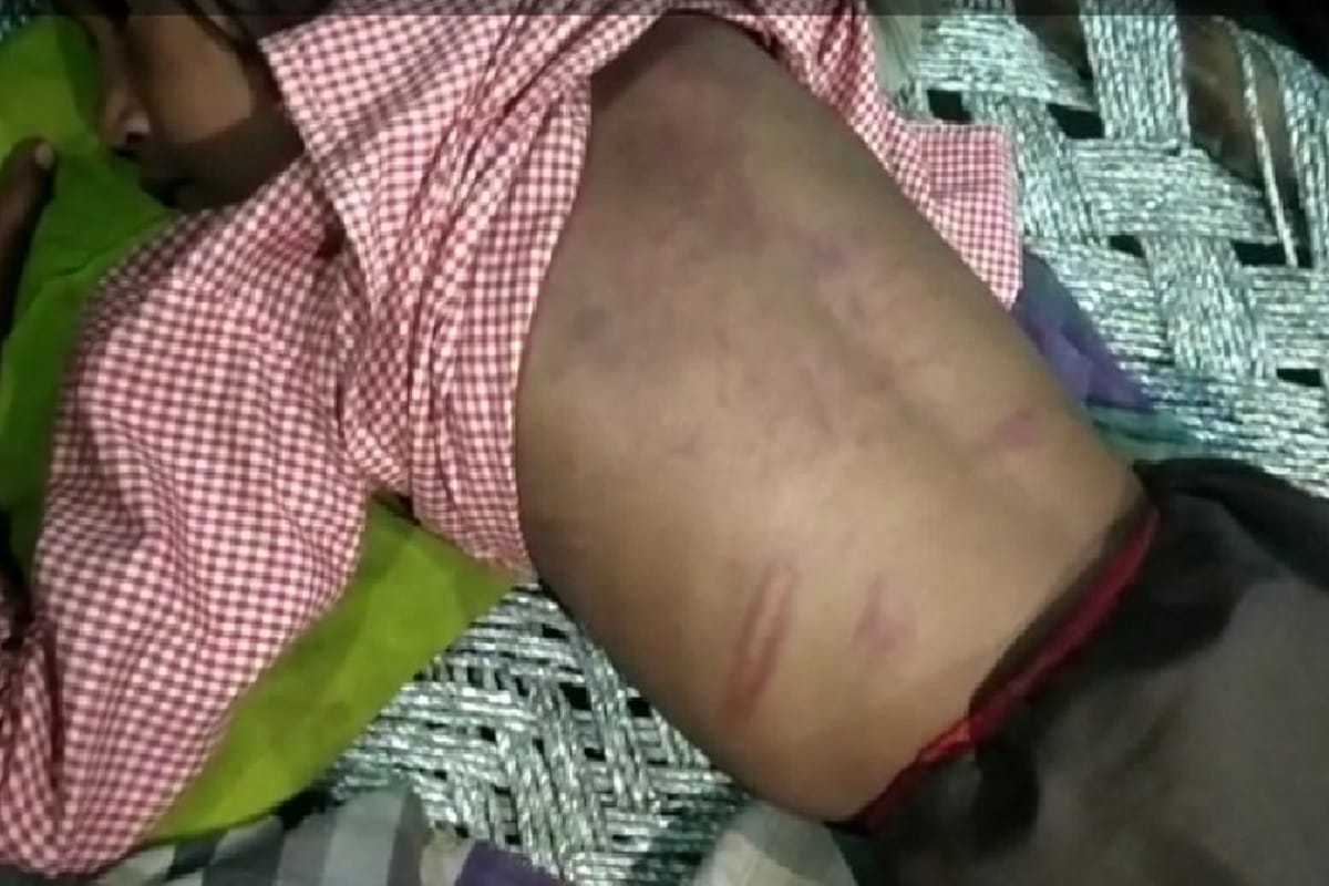 A teacher of primary school beaten up second class student girl at Bijnor city