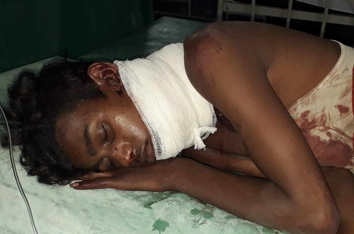 Calling from home, Kishore was strangled, referred in critical condition
