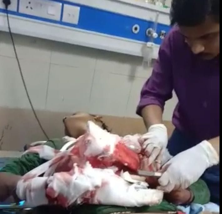 sword attack, fingers cuts in rajiv colony