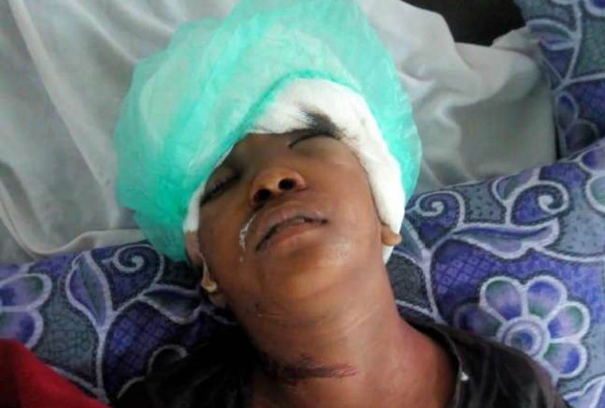 child caught in generator,  hair dislocated with flesh from head, died at kgmu trauma center