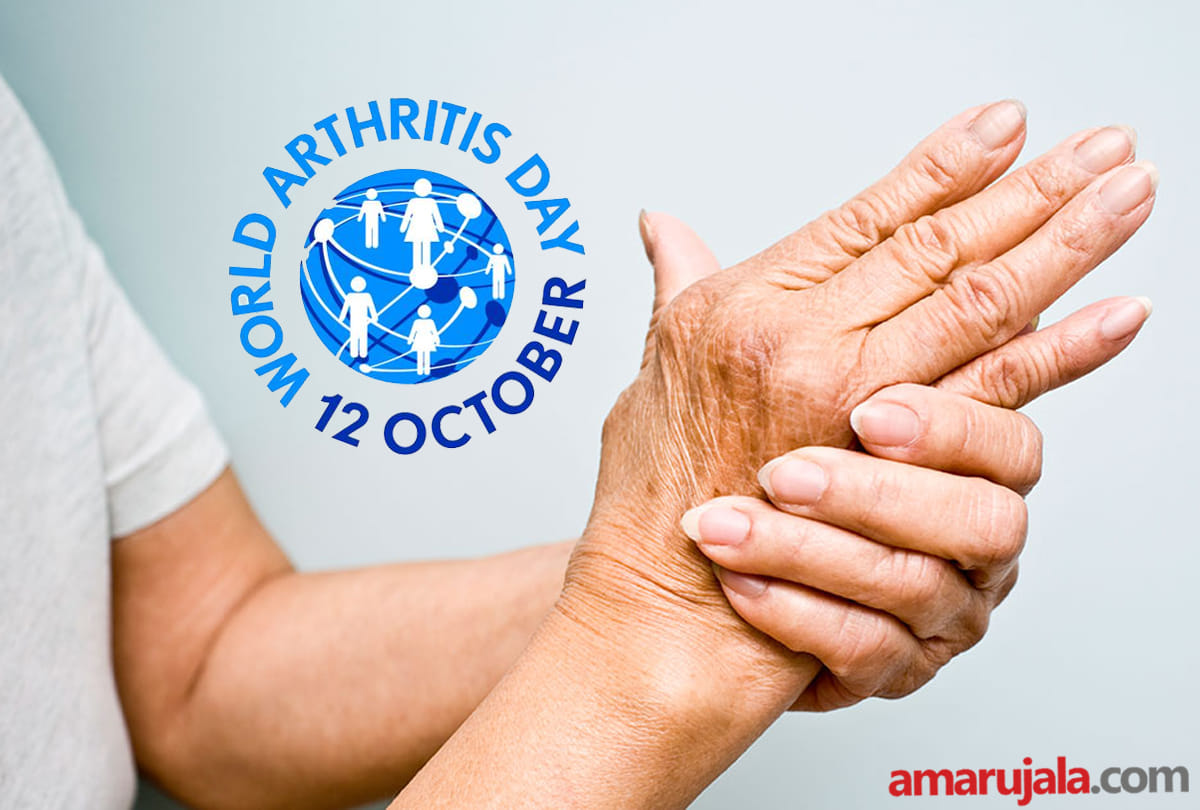 World Arthritis Day Corona causing more damage to arthritis patients