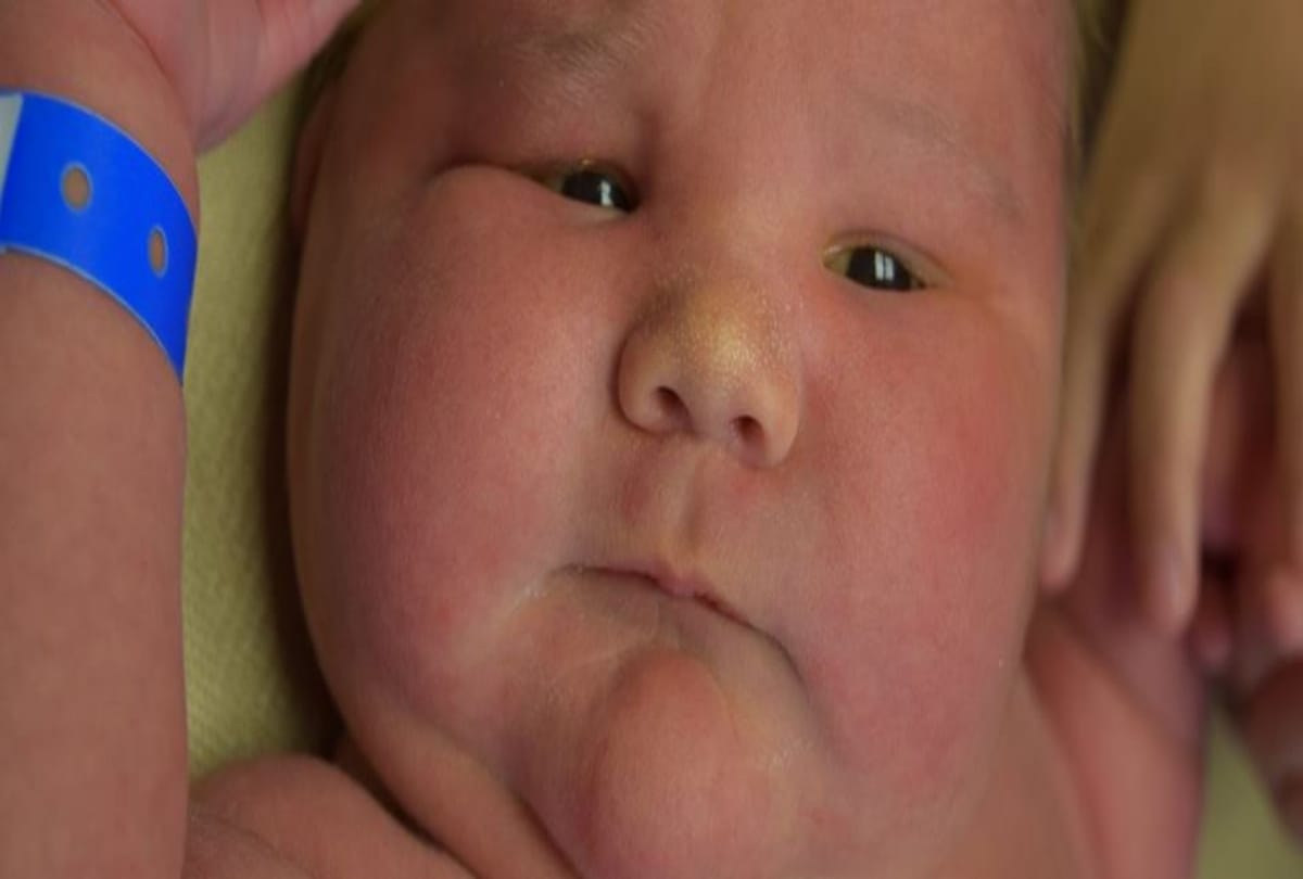 mini sumo wrestler mother gives birth overweight baby