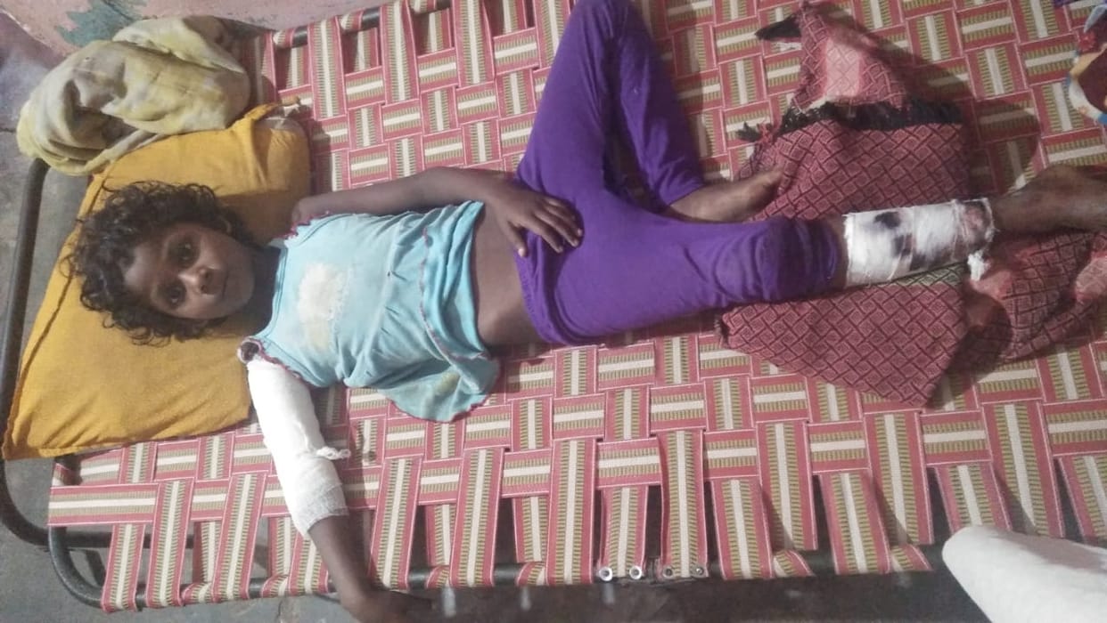 girl injurd in wall fall