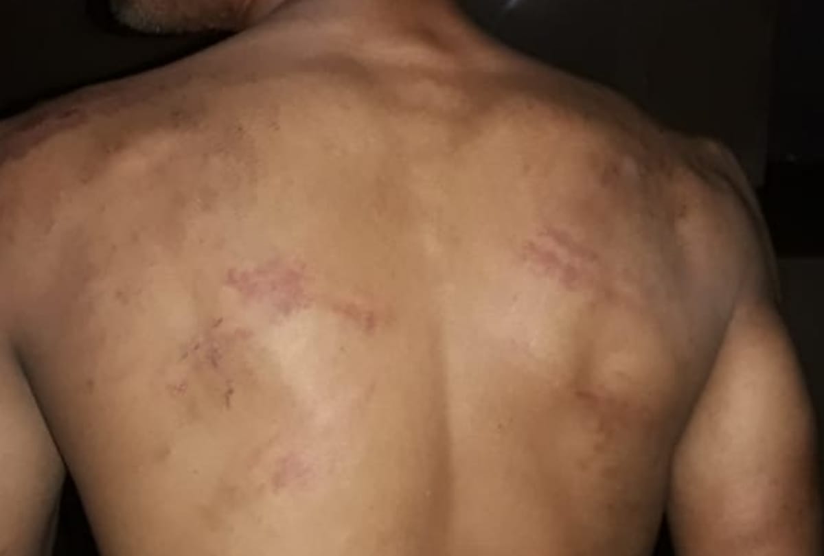 GRP beaten a man in lucknow