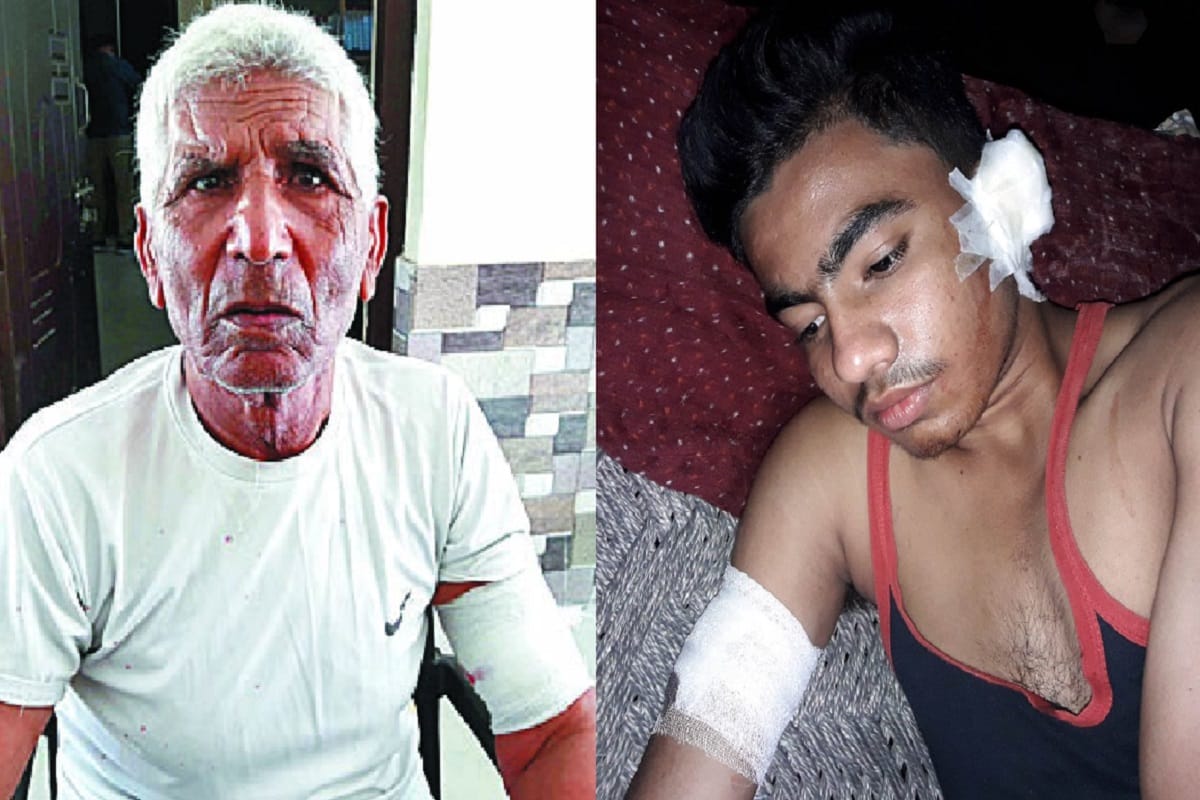 Monkeys attacked on people in Baghpat and many injured