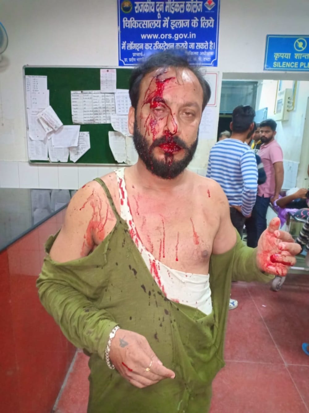 Attack on the state president of INTUC, admitted in Doon Hospital