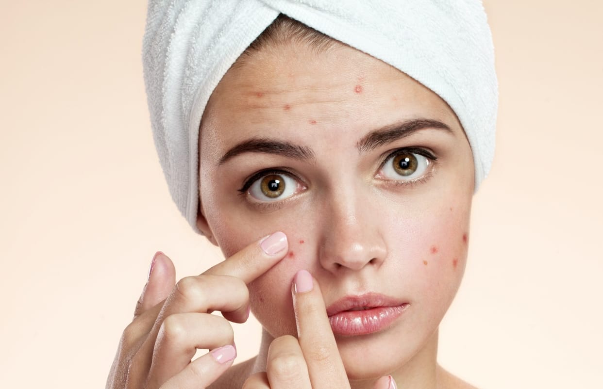 for pimple reducing  and spotless and shiny face try these asan