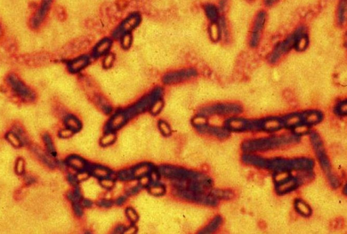 What is zoonotic diseases due to which 2 million people die every year