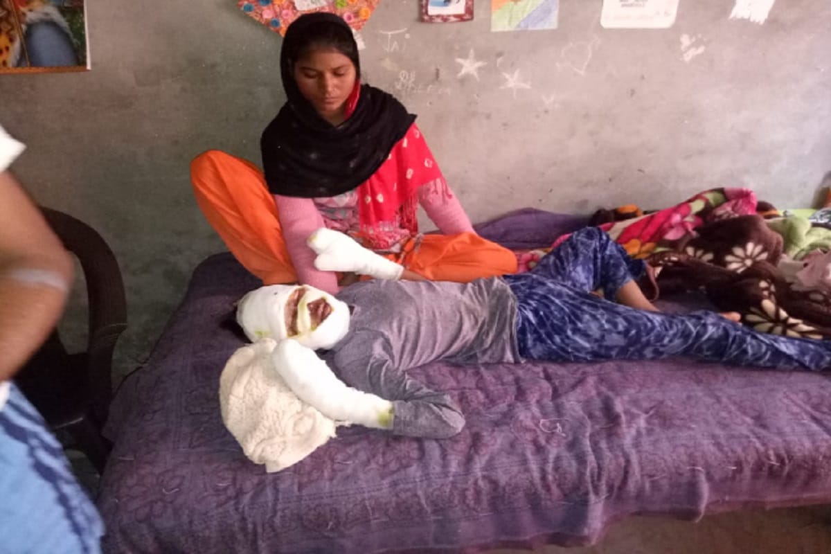 Blast in diwali gift in a village at Meerut district and two sisters has injured