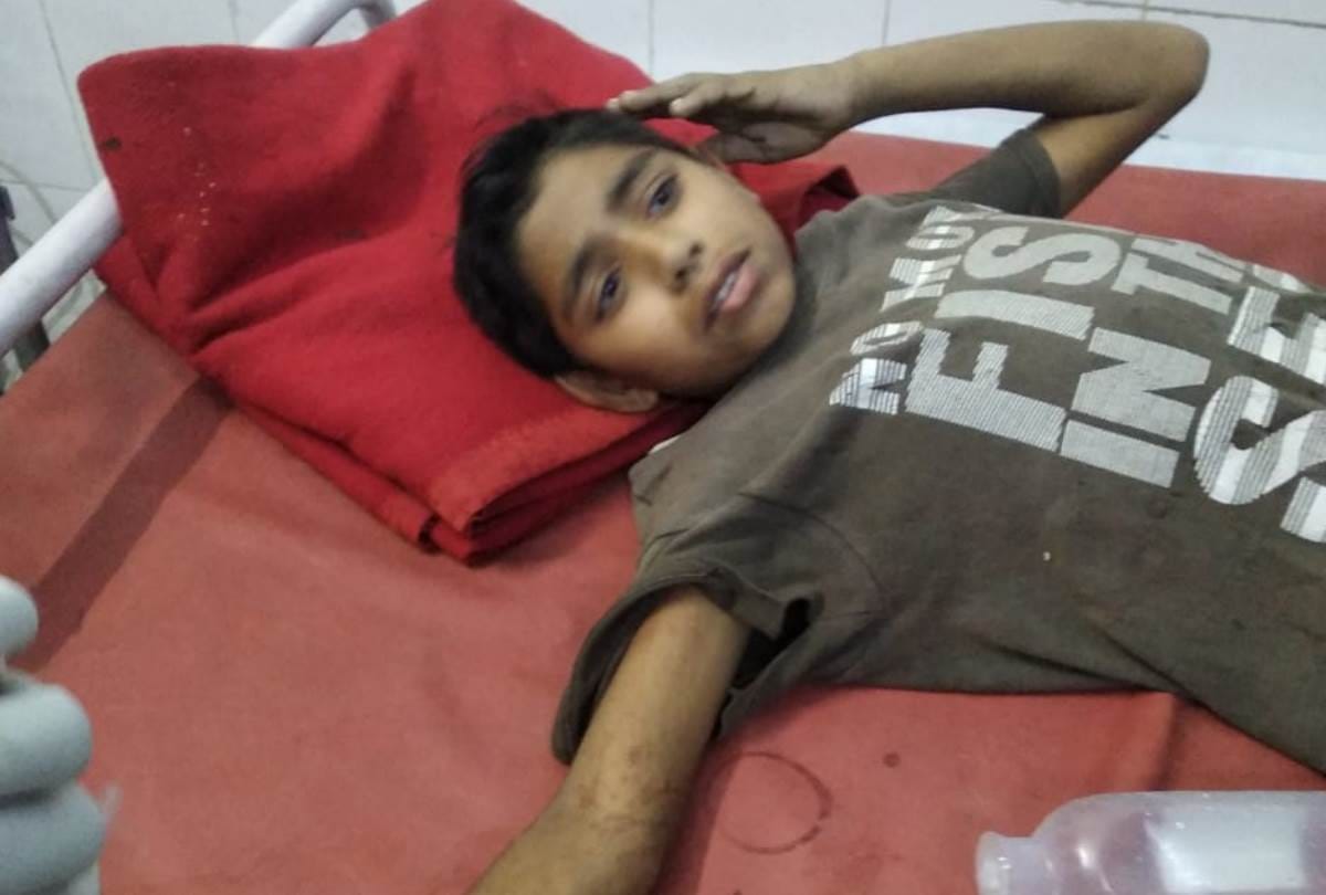 amethi : cracker blast in hand, rags fly, trauma center refer