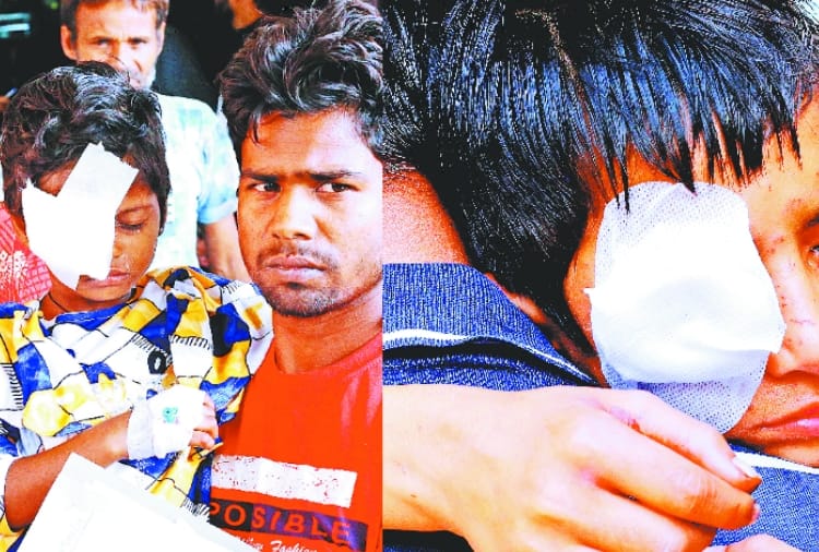 Firecrackers hurt eyes of Many Peoples during Diwali