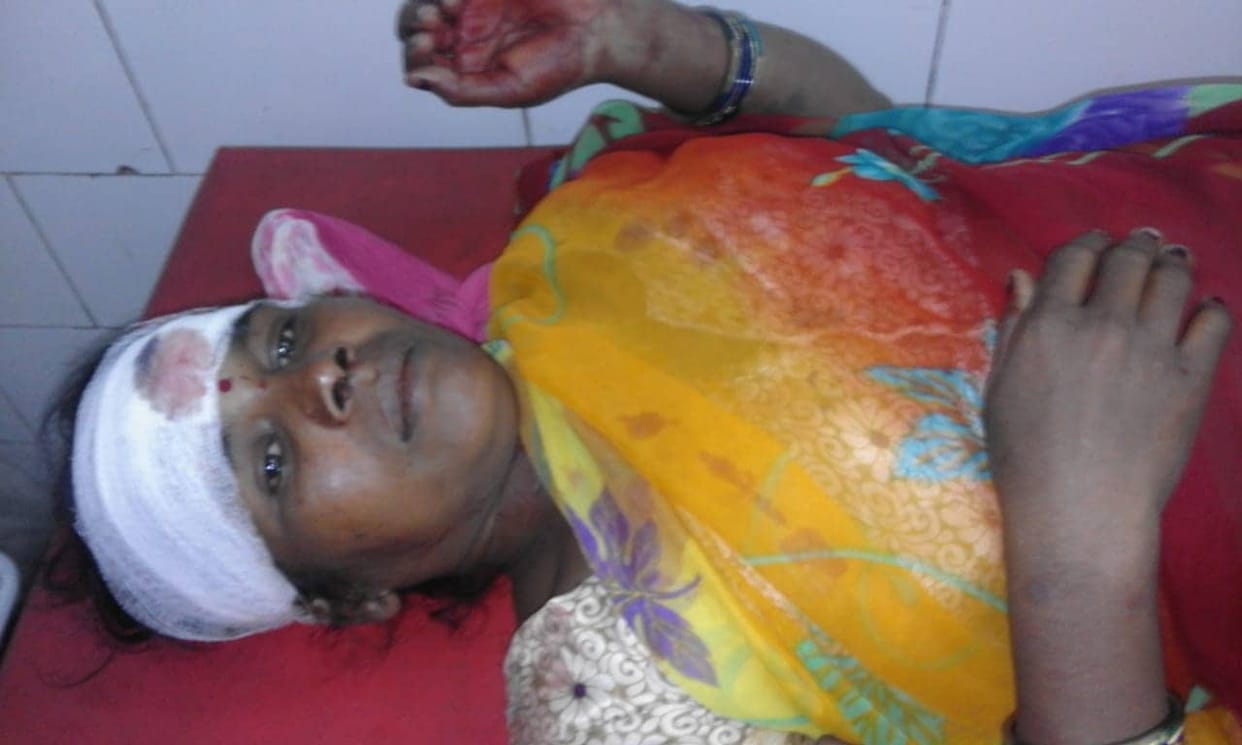 Rudrapur: Ruckus caused by stoning a dog, many people injured