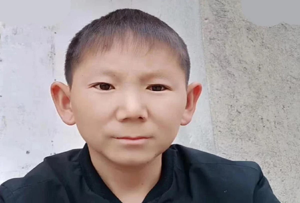 34 year old man look like a child because of a Head injury in China