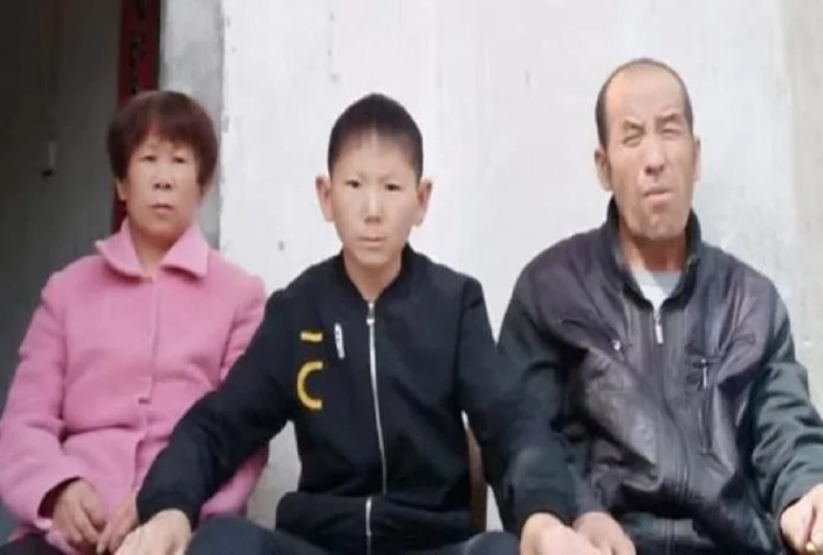 34 year old man look like a child because of a Head injury in China