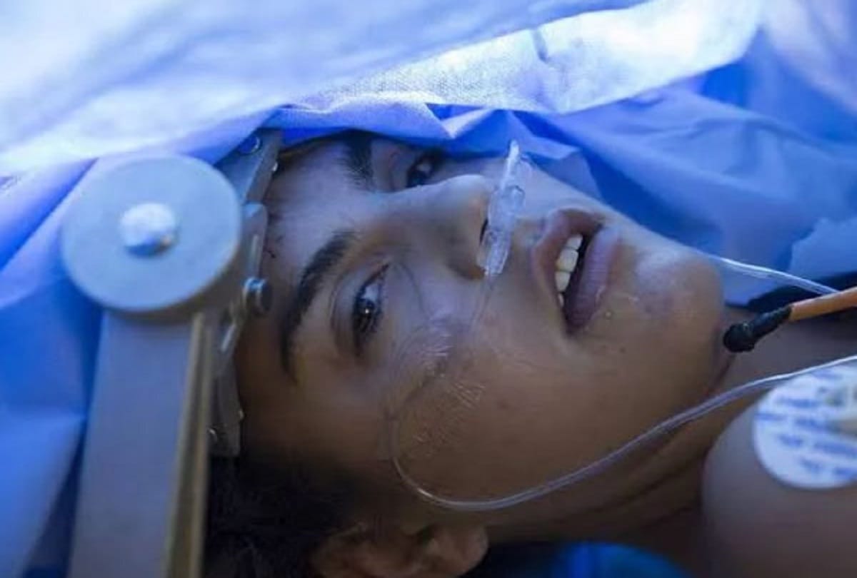 Doctors did brain surgery without making the girl unconscious, thousands of people watched fb live