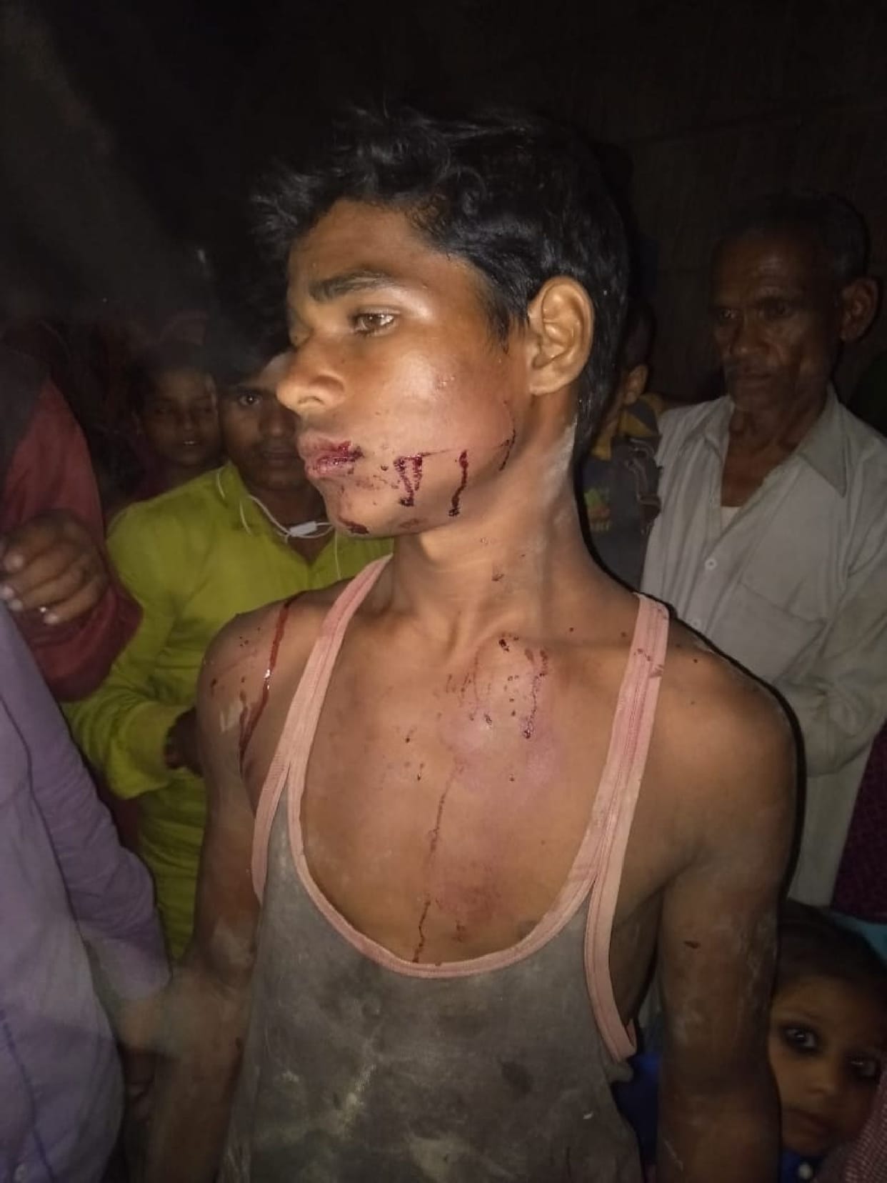 Leopard injured young man in field
