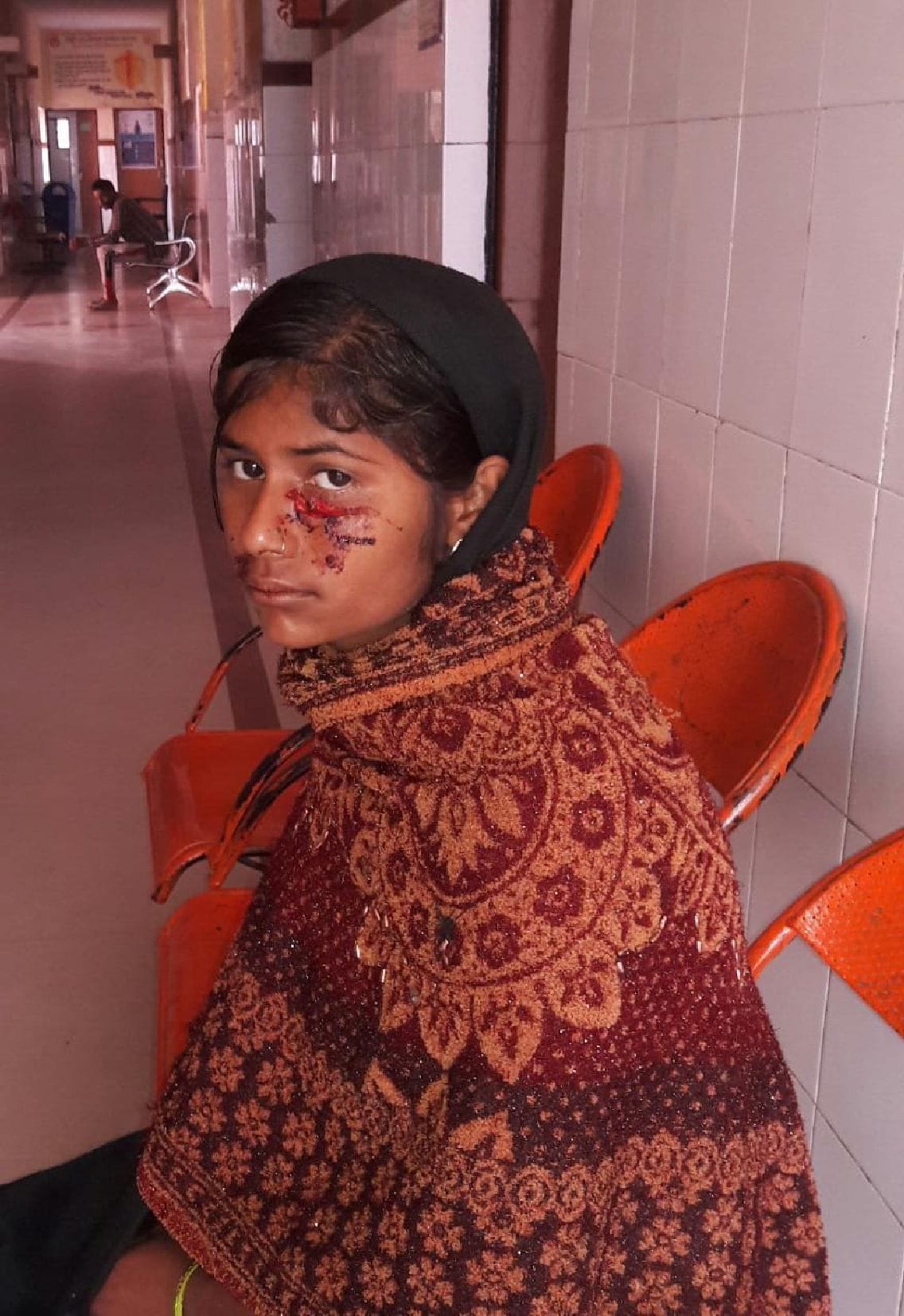 Woman injured in jackal attack