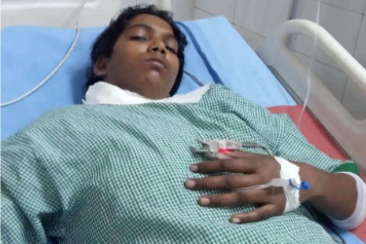 women was burnt by husband