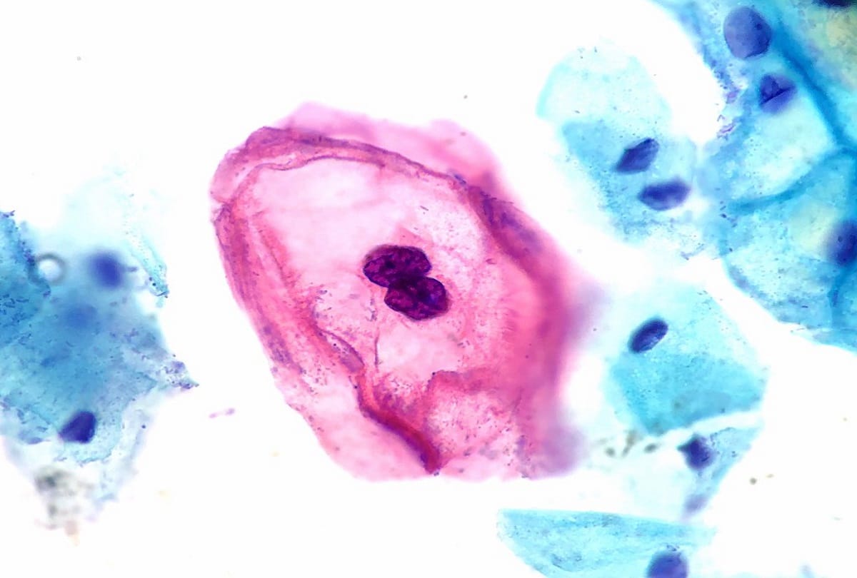 sexually transmitted Infections and diseases