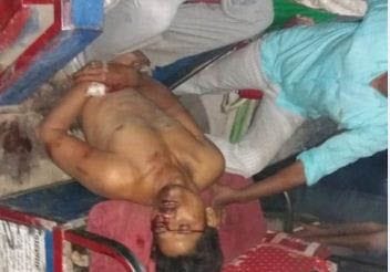 Policeman was beaten with a cloth in his mouth in Sikanderrau, Hathras