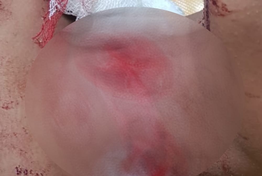 boy attacked on a girl with knife in lucknow, condition serious