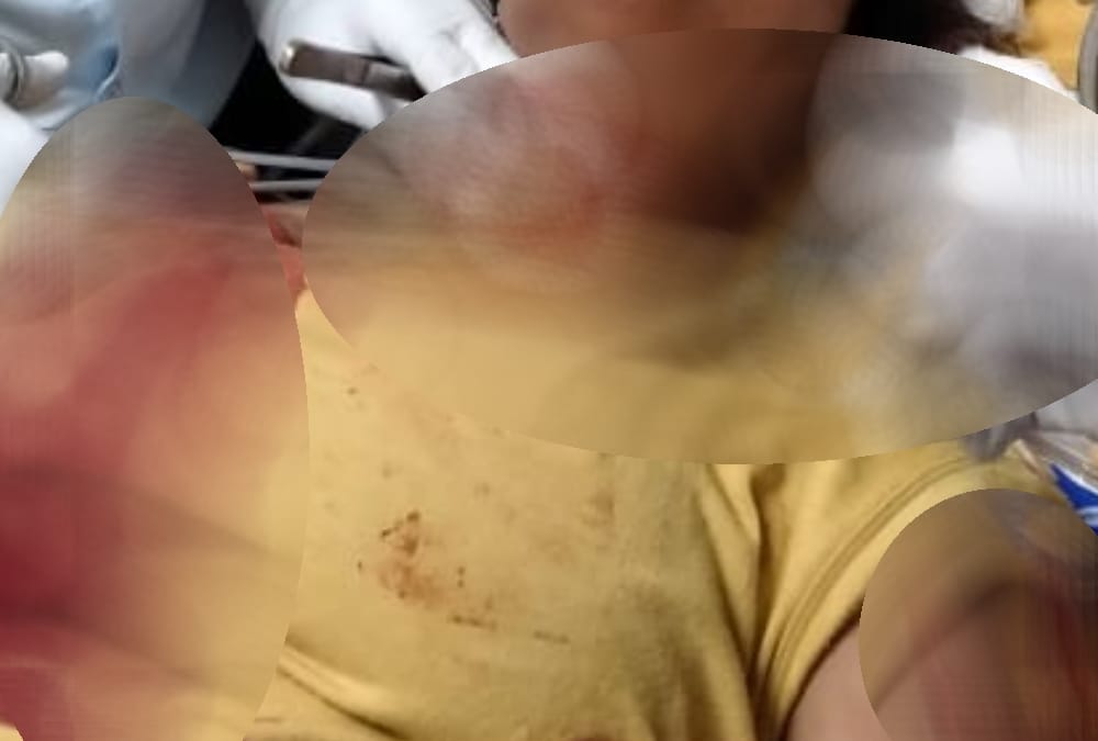 boy attacked on a girl with knife in lucknow, condition serious