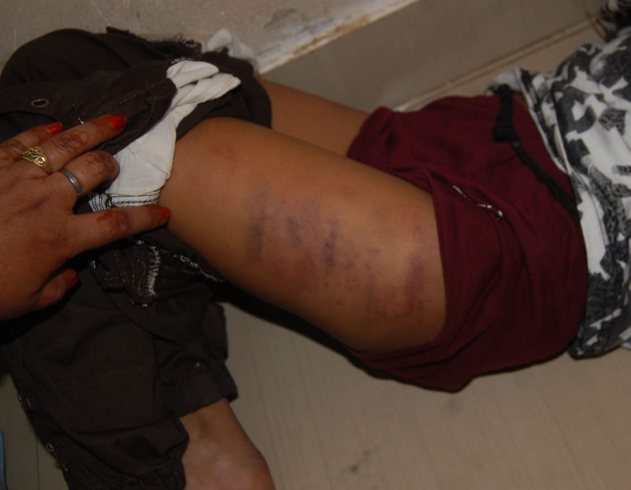 Student injurded by beating