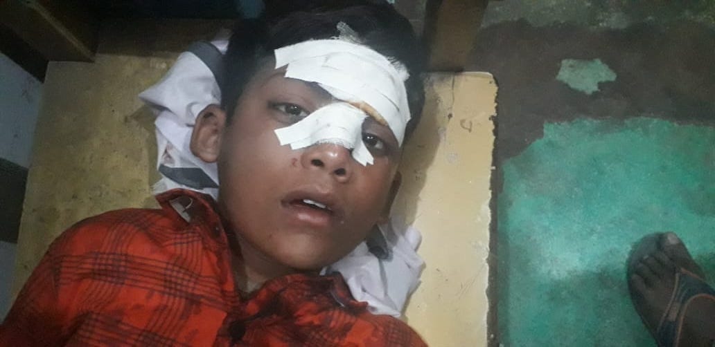 kanpuer dehat accidant