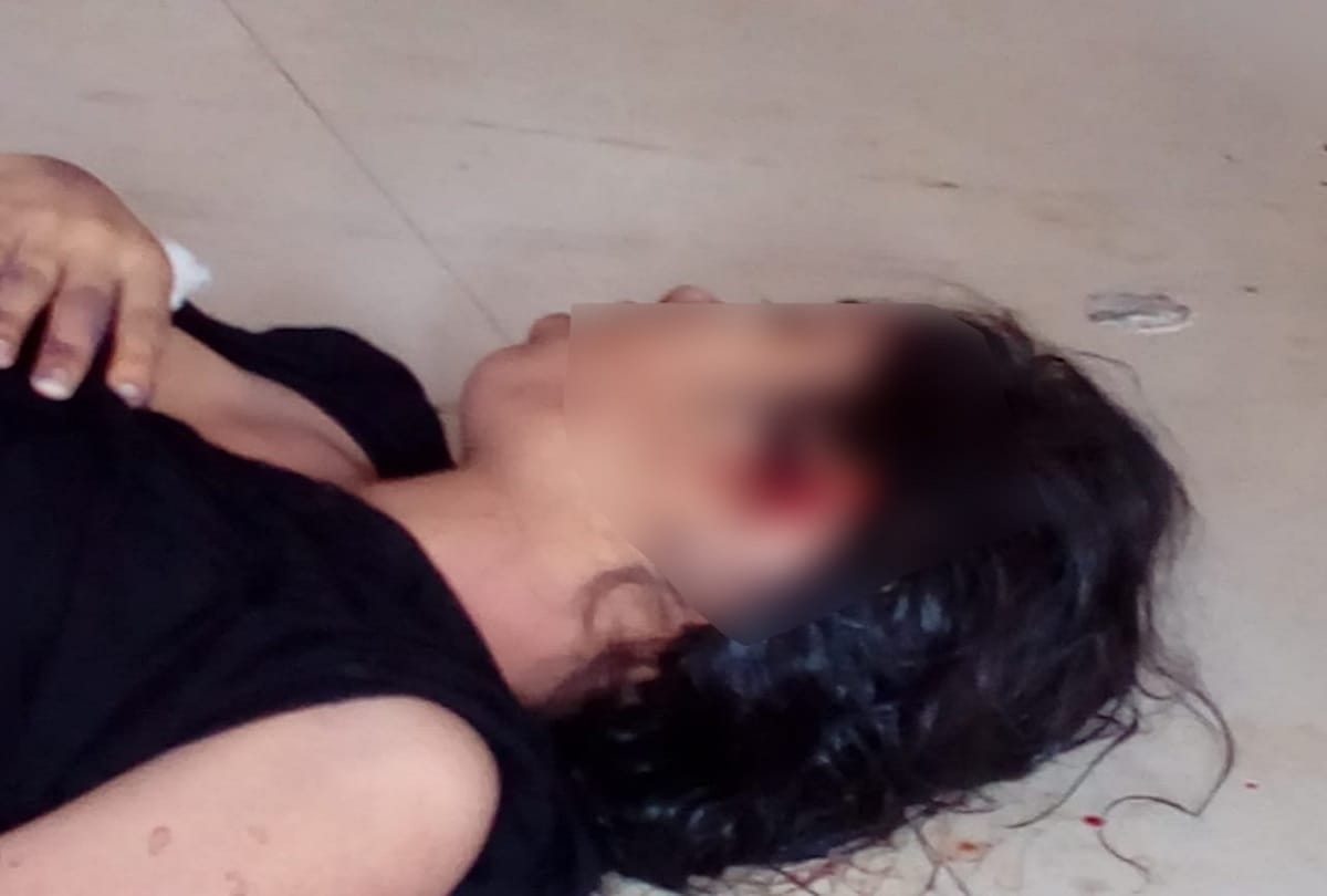 Rats ate the deceased girl ear In the post mortem house
