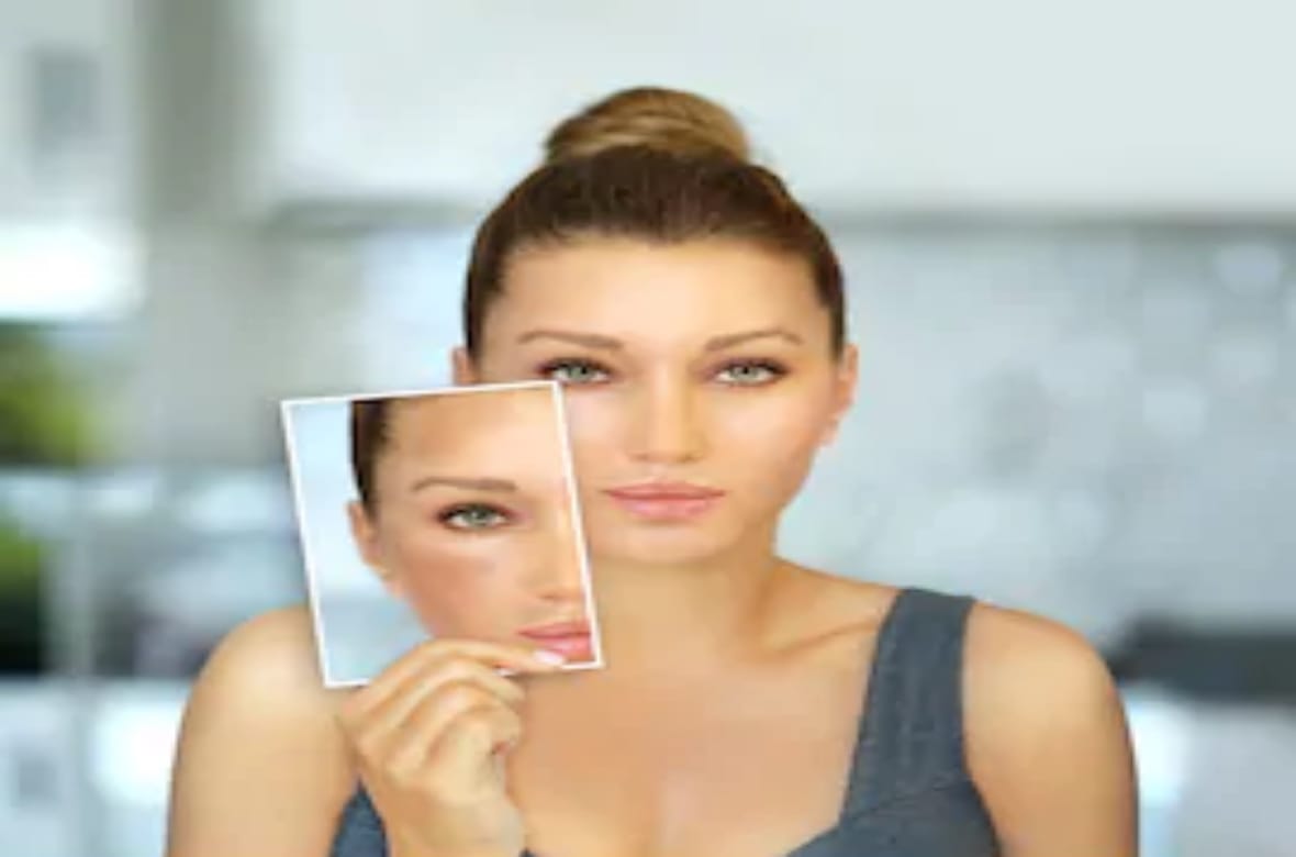 mix curd and beetroot to get rid of pigmentation on face