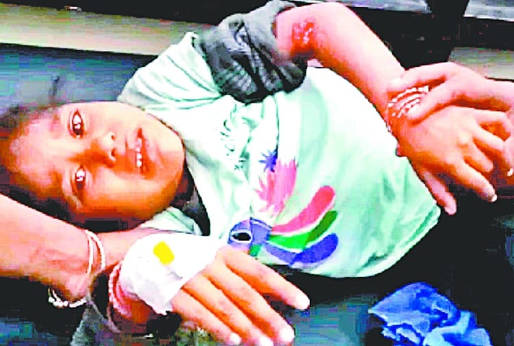 dog bite, stray dogs attack on girl child playing outside house