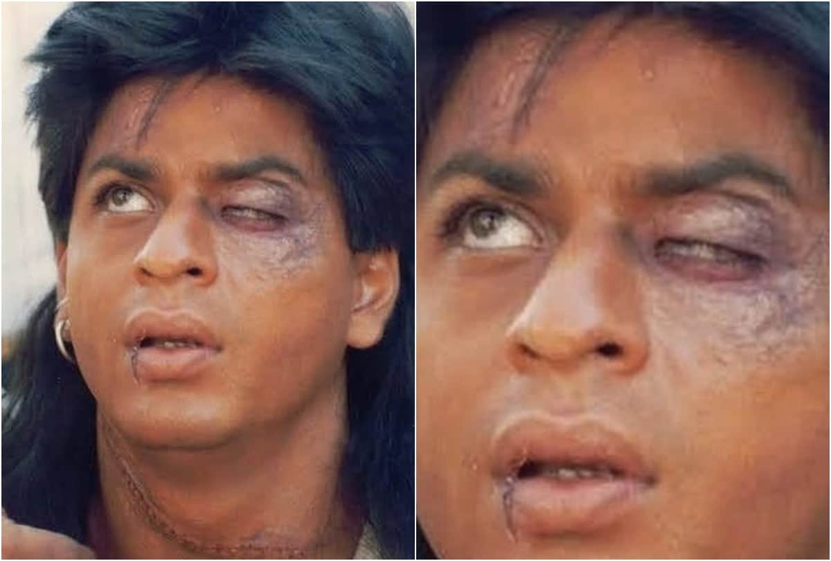 Twitterati trolled Shah Rukh Khan black eyed picture after entertainment magazine shared a photo