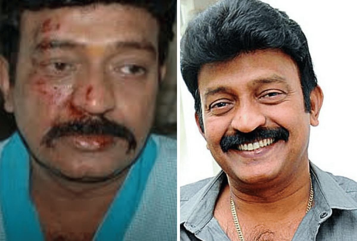 Telugu Actor Rajasekhar Car Accident Escapes with Minor Injuries
