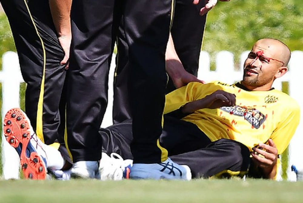 Australias Ashton Agar suffers laceration to his nose 