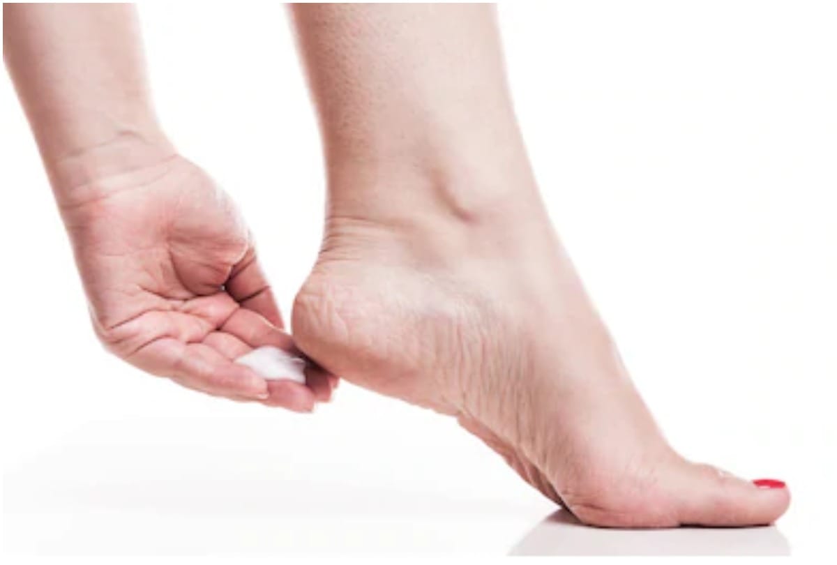 daily heel care routine for cracked heel