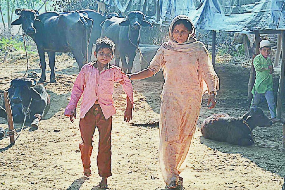 Life of children suffering from malnutrition becomes difficult