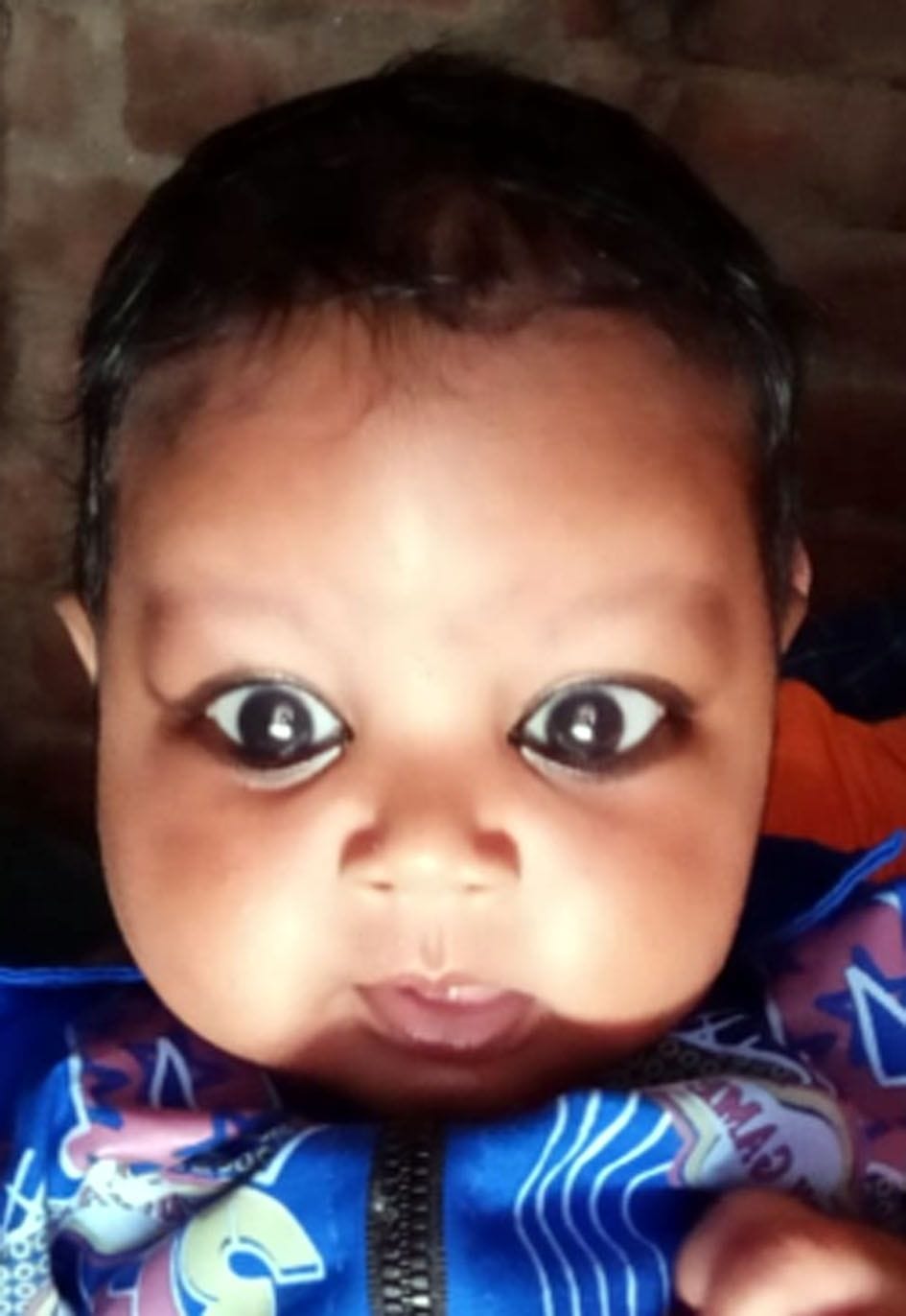 dengu, death of child in kasganj