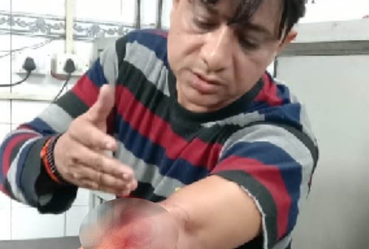 men shot a teacher santosh, injured in lucknow