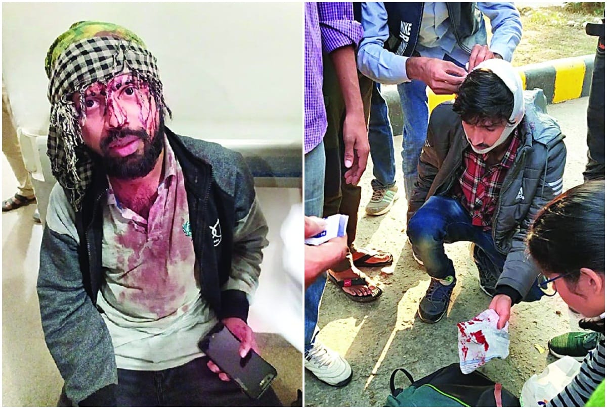50 injured students of JNU arrive at AIIMS Trauma Center
