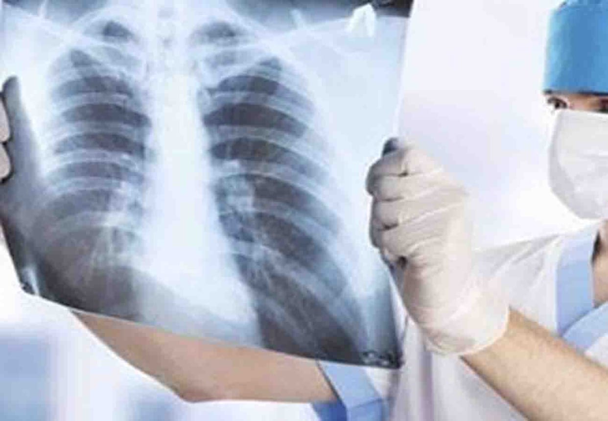Eight medical store operators and municipal president adopt nine children suffering from TB