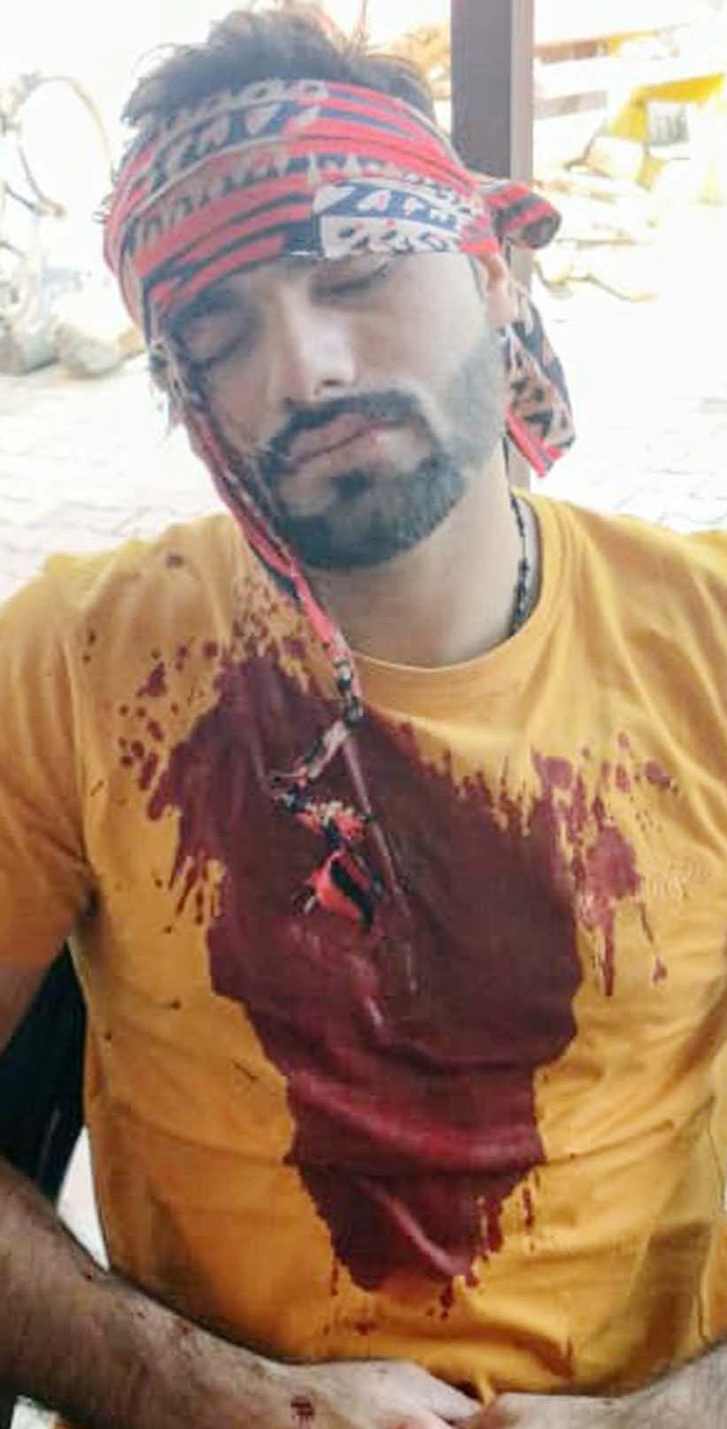 one dozzen person injured in gate vivad
