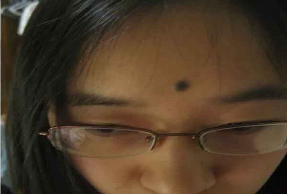 Mole on body parts are lucky after marriage