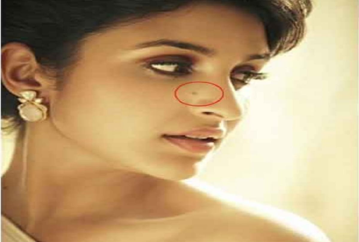 Mole on body parts are lucky after marriage