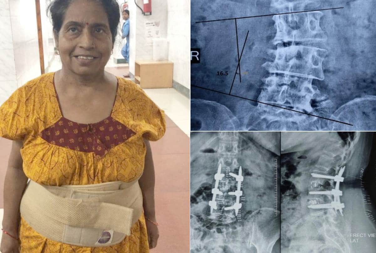 neurosurgeon of lohia sansthan gave new life to lady