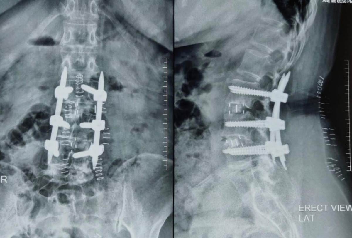 neurosurgeon of lohia sansthan gave new life to lady