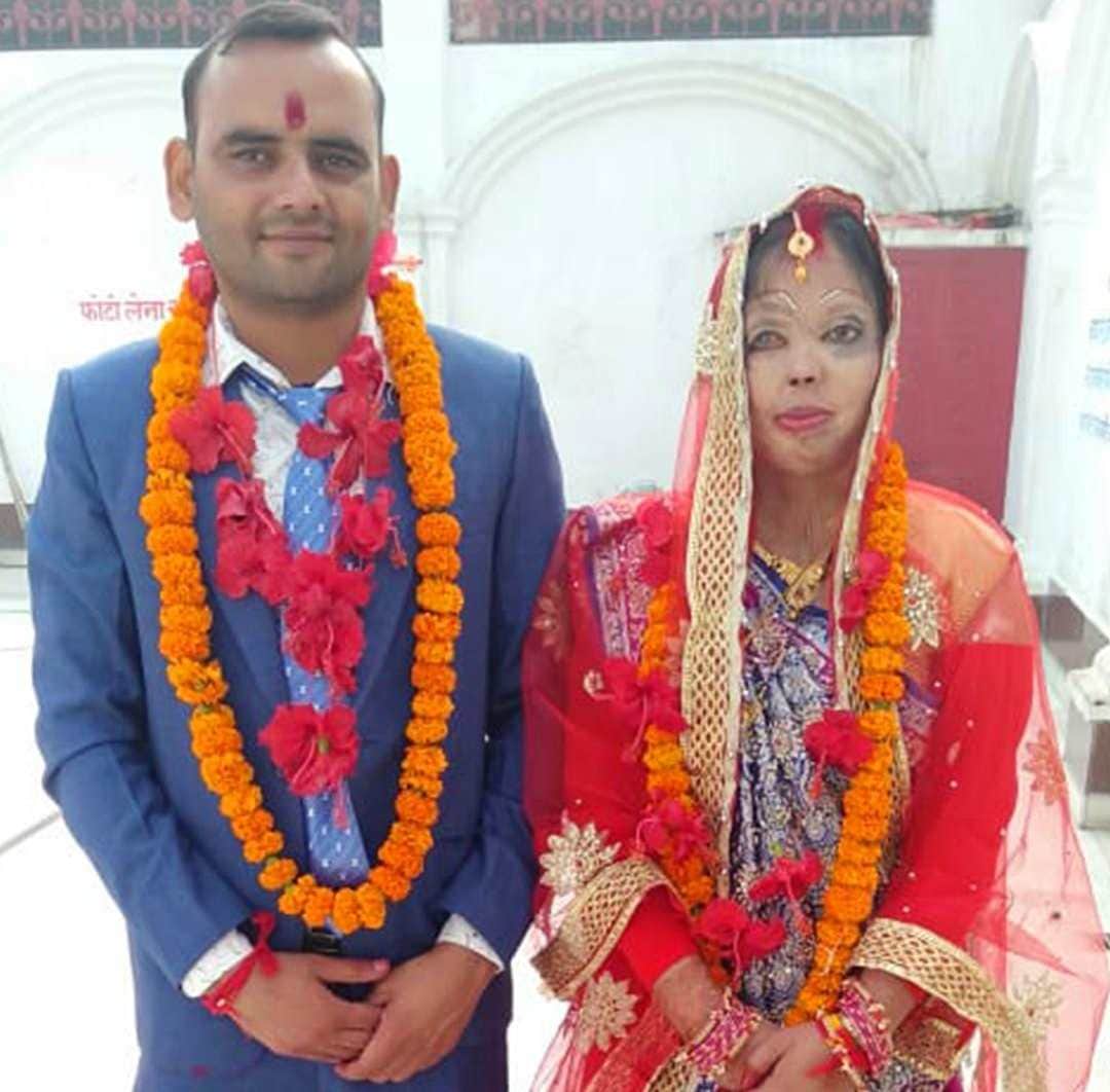 shah rukh khan share wedding photos of acid attack survivor anupama