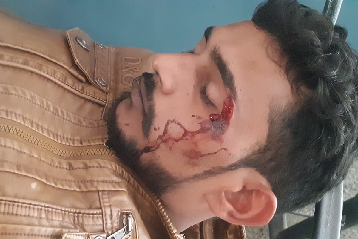 Many peoples was injured in fight two sides at Bijnor district