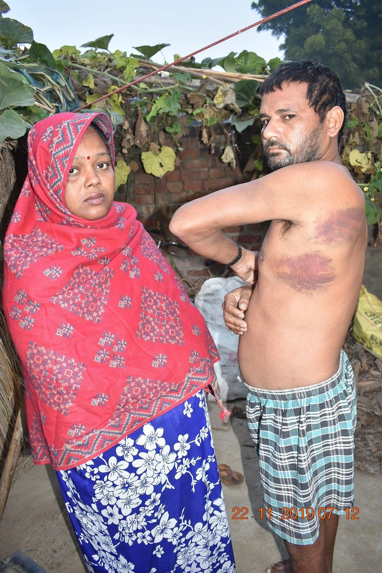 Bullies beaten up, police is not taking action