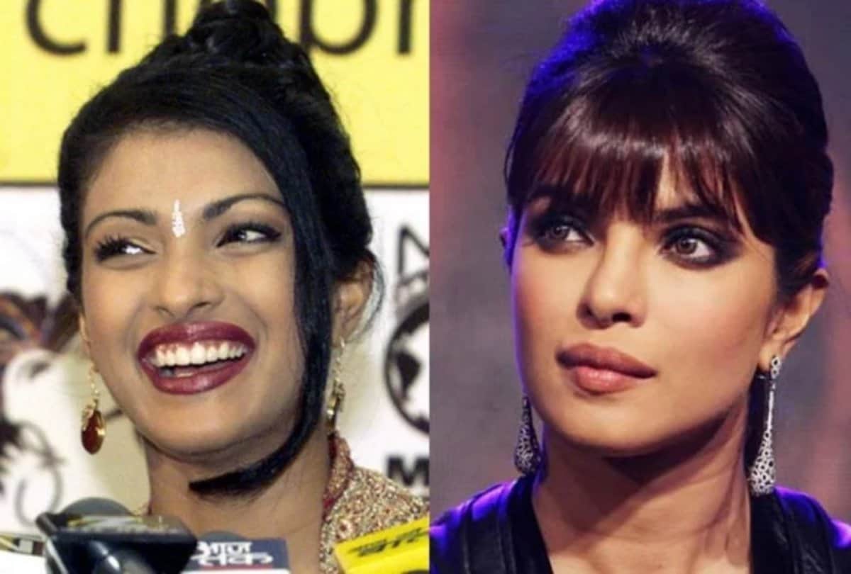 Anushka Sharma to Kangana Ranaut List Of Bollywood Actresses Who Have Had Plastic Surgery