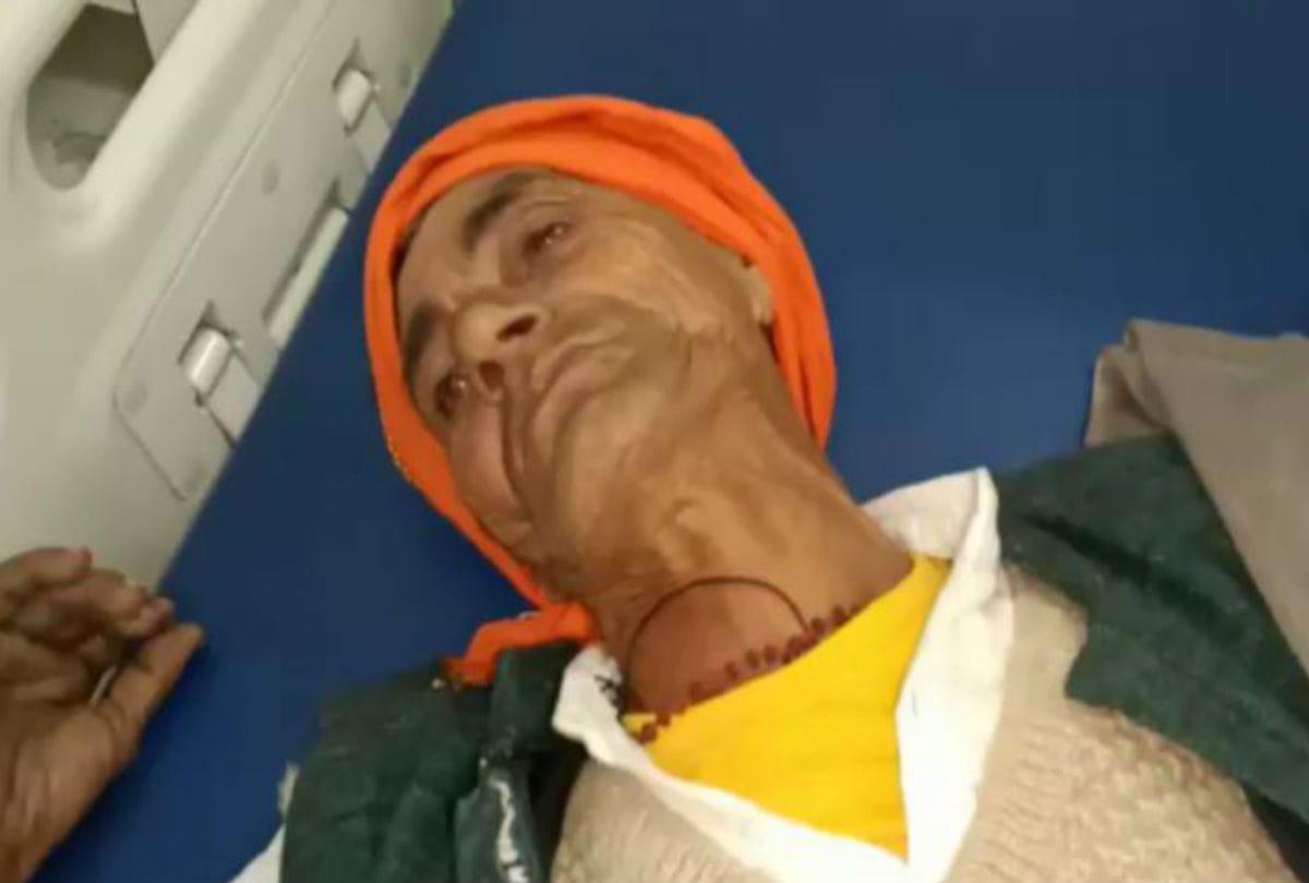 Attack on Family By Flammable substance in Firozabad Crime News